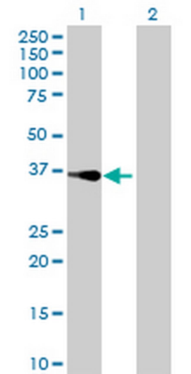 RTDR1 Antibody in Western Blot (WB)