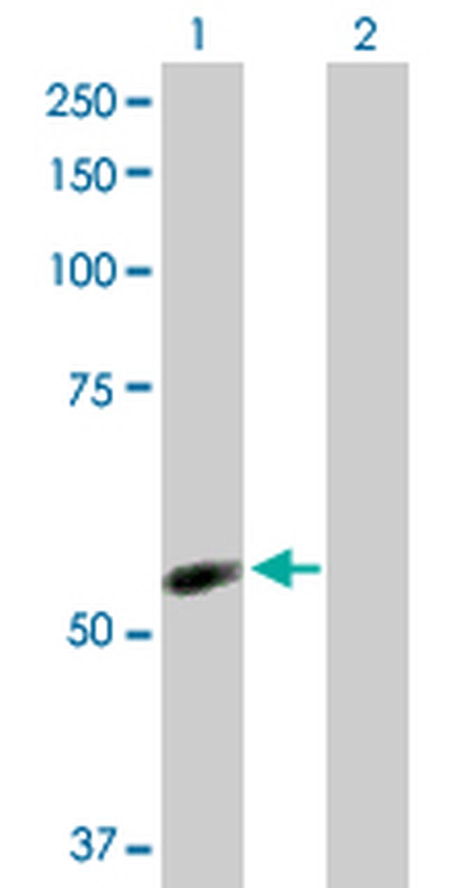 NDOR1 Antibody in Western Blot (WB)