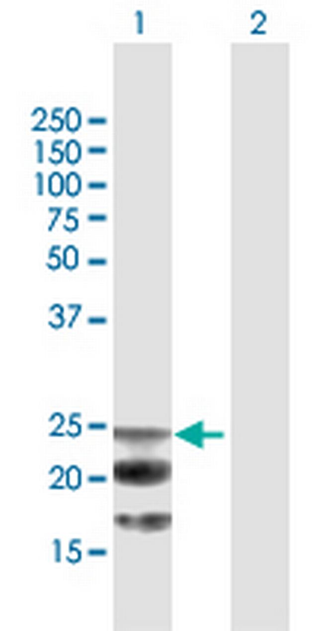 NAAA Antibody in Western Blot (WB)