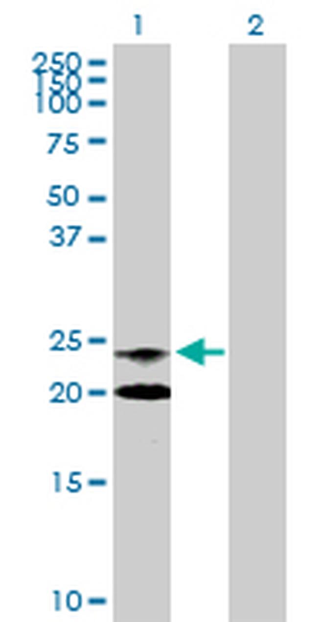 NAAA Antibody in Western Blot (WB)