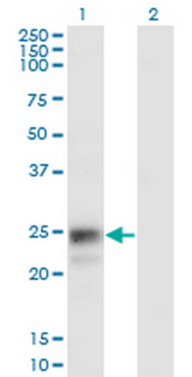 NAAA Antibody in Western Blot (WB)