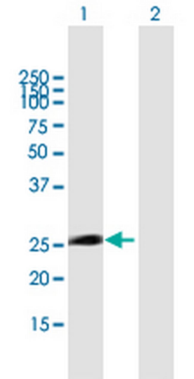 ITGB1BP3 Antibody in Western Blot (WB)