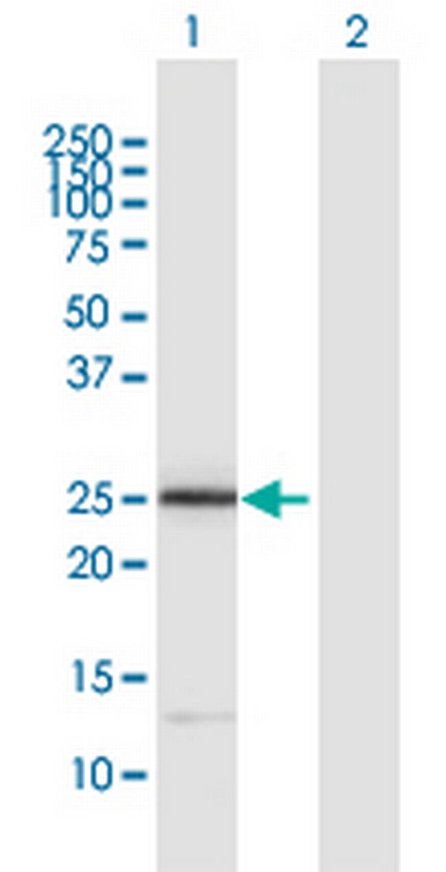 ITGB1BP3 Antibody in Western Blot (WB)