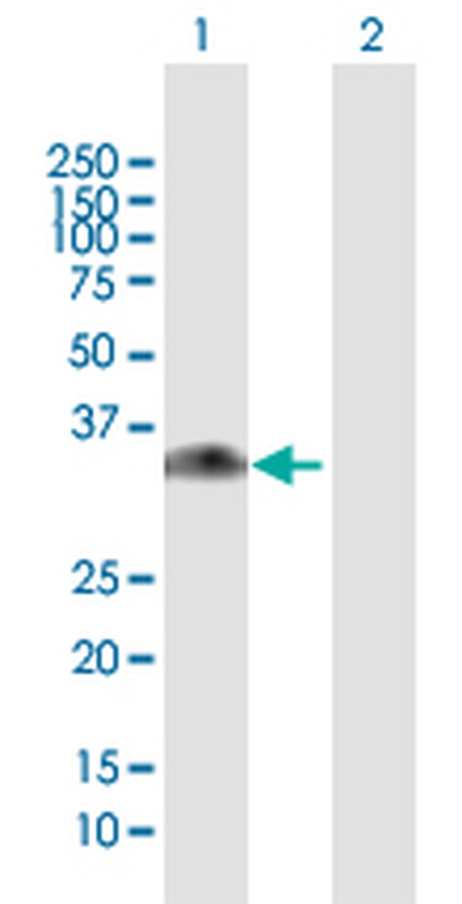 GNMT Antibody in Western Blot (WB)