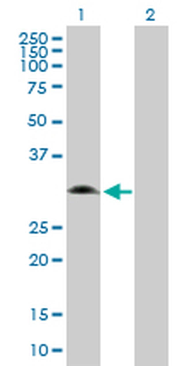 GNMT Antibody in Western Blot (WB)