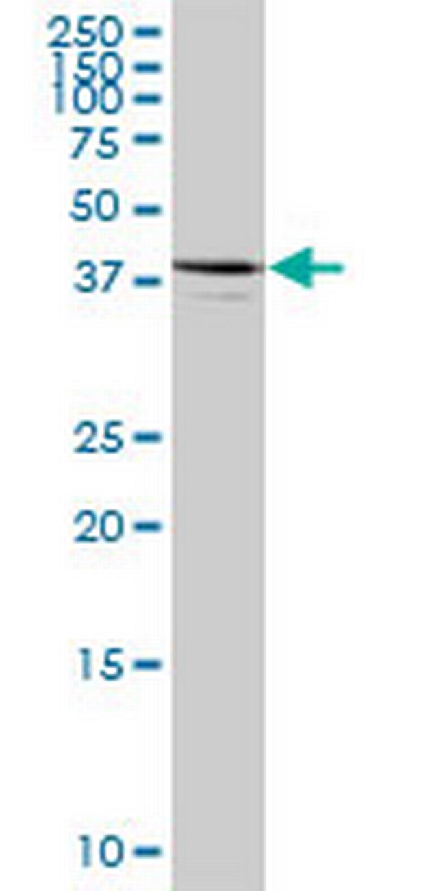 ARFIP1 Antibody in Western Blot (WB)