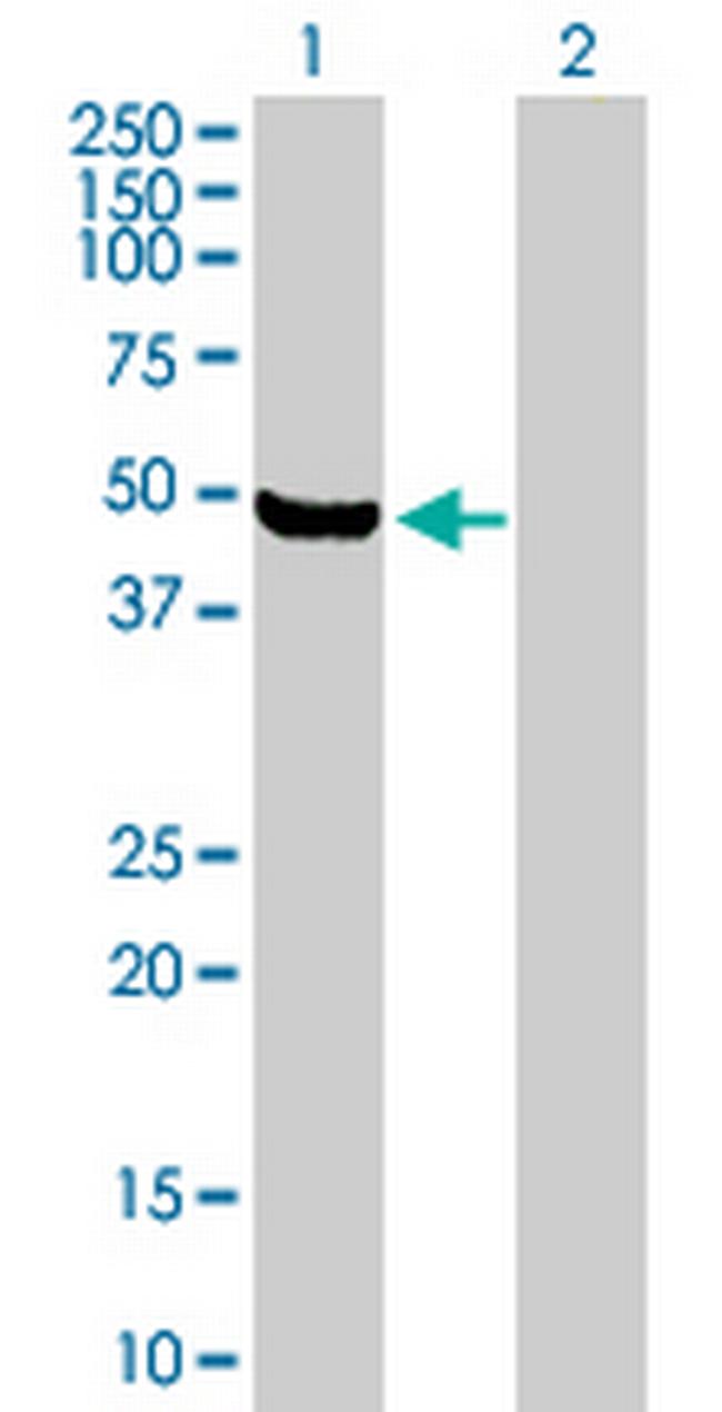 ARHGEF16 Antibody in Western Blot (WB)