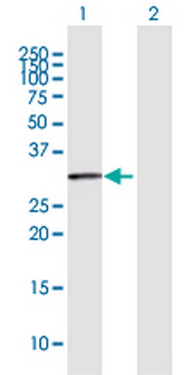 BBS9 Antibody in Western Blot (WB)