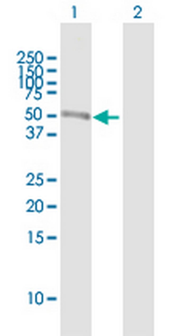 AHDC1 Antibody in Western Blot (WB)