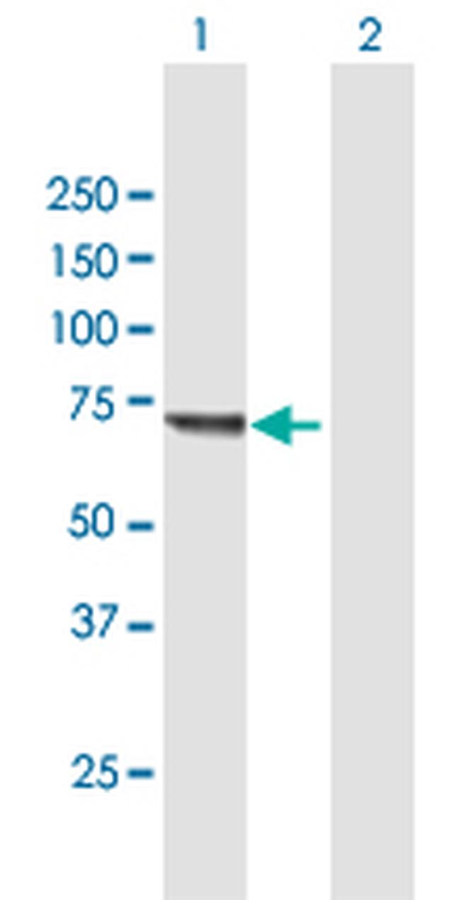 KLHL20 Antibody in Western Blot (WB)