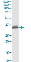 SULT1B1 Antibody in Immunoprecipitation (IP)