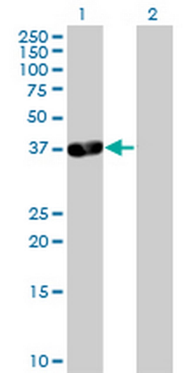 PDLIM3 Antibody in Western Blot (WB)