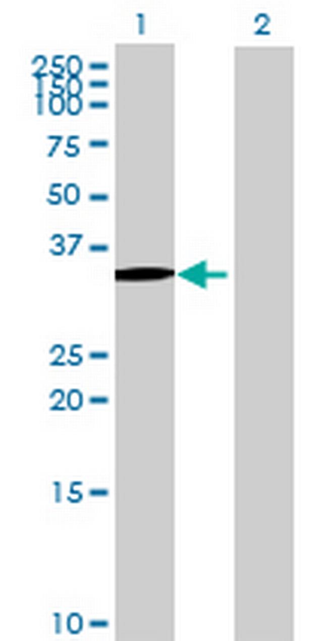 PDLIM3 Antibody in Western Blot (WB)
