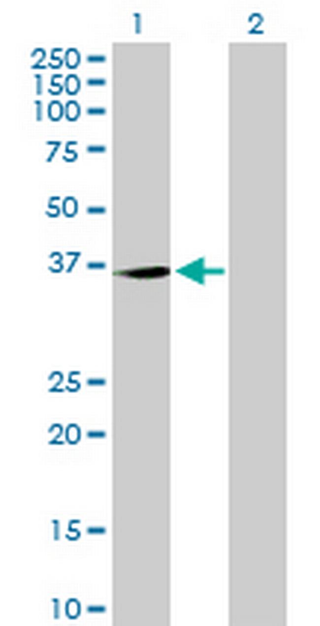 C20orf10 Antibody in Western Blot (WB)