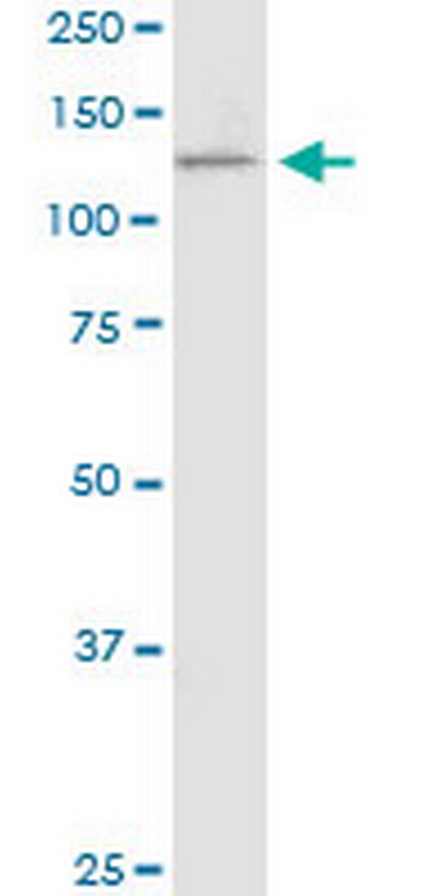 PCDH11X Antibody in Western Blot (WB)