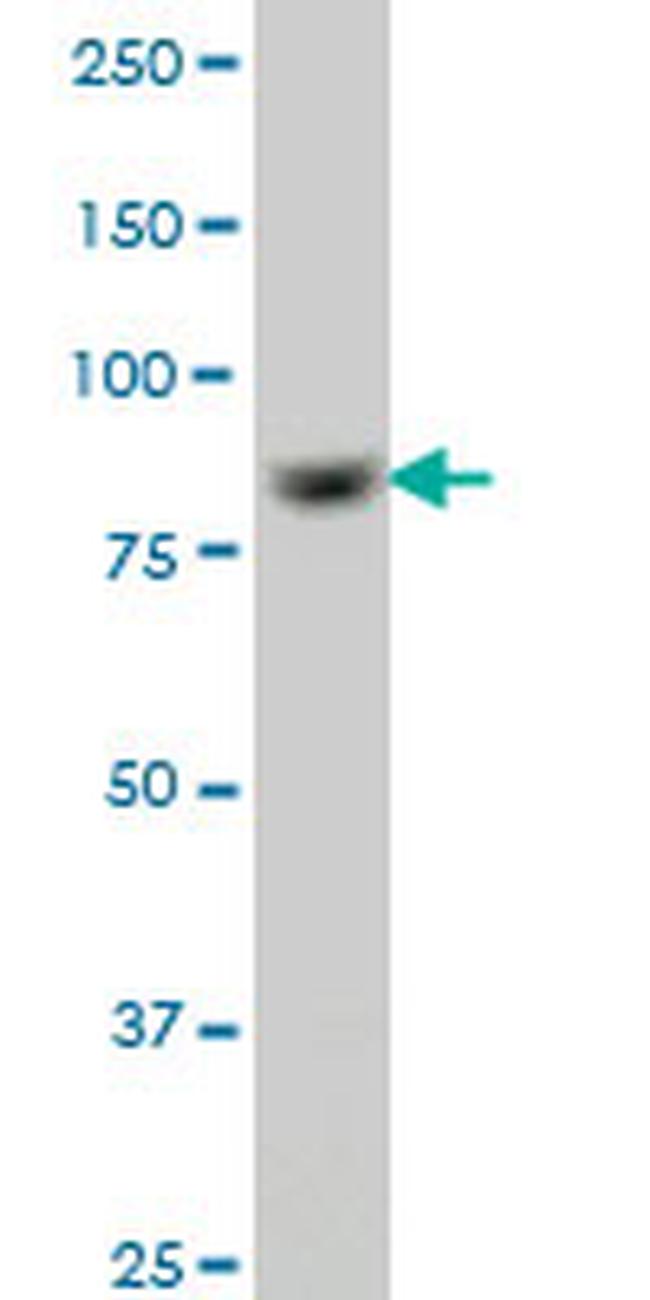 RPS6KA6 Antibody in Western Blot (WB)