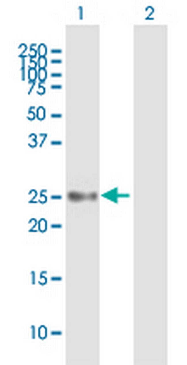 UBE2S Antibody in Western Blot (WB)