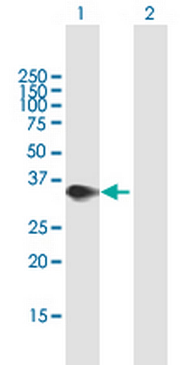 PPP2R3B Antibody in Western Blot (WB)