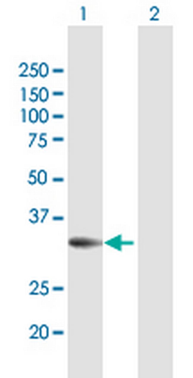 PPP2R3B Antibody in Western Blot (WB)
