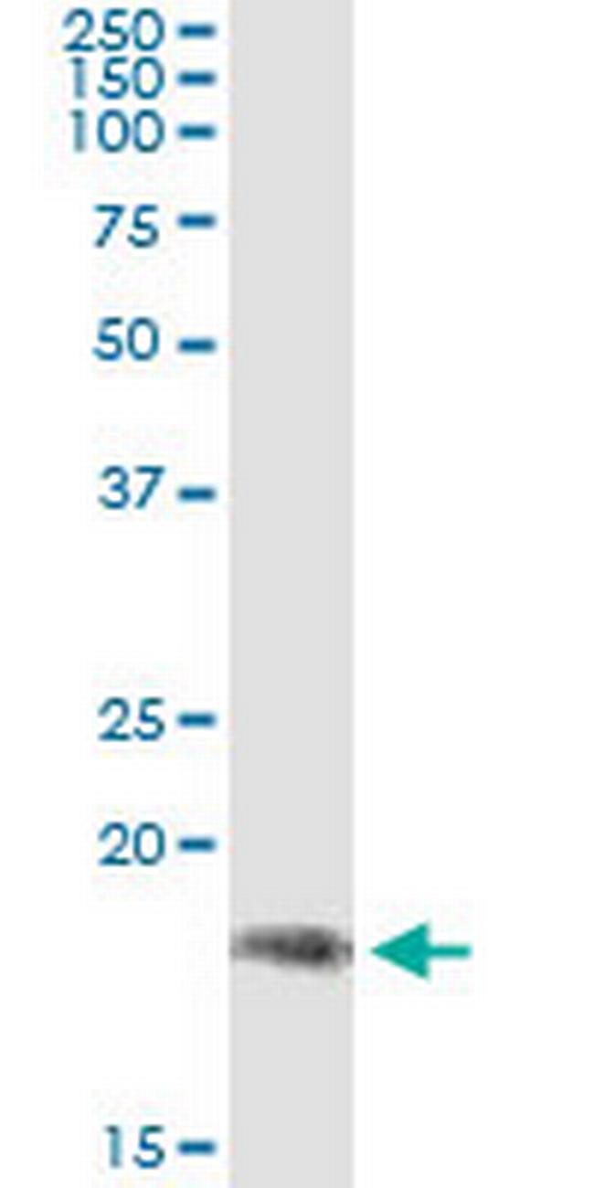 PPP2R3B Antibody in Immunoprecipitation (IP)