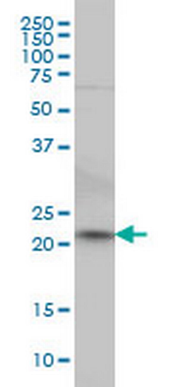 NKIRAS2 Antibody in Western Blot (WB)