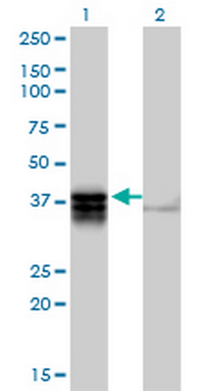 TRDD3 Antibody in Western Blot (WB)