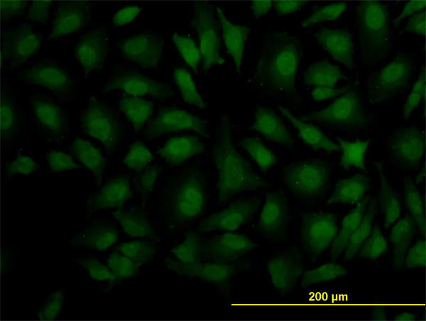 DCPS Antibody in Immunocytochemistry (ICC/IF)
