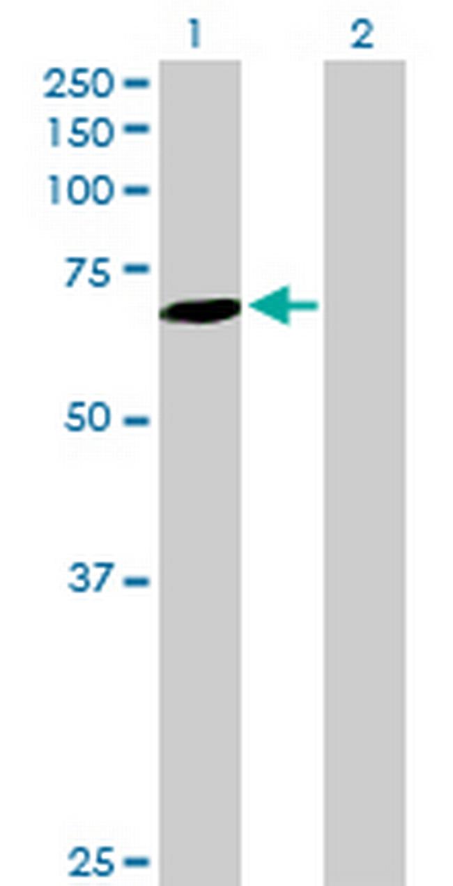SLC27A6 Antibody in Western Blot (WB)