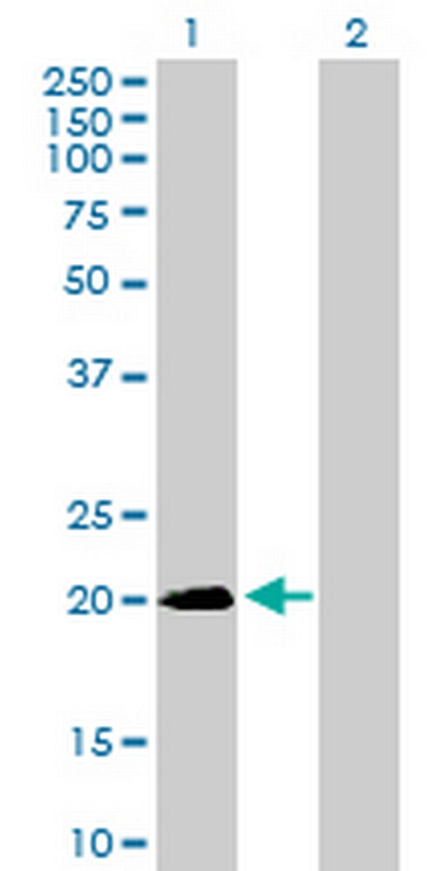 SNX24 Antibody in Western Blot (WB)