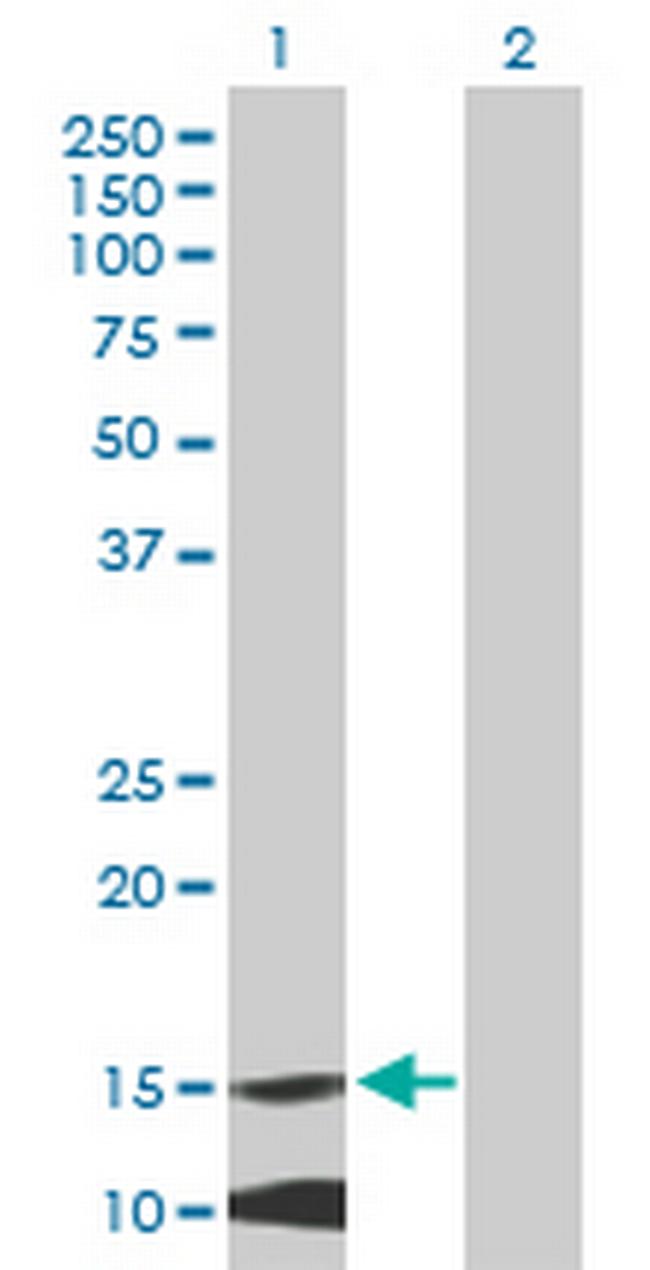MRPL42 Antibody in Western Blot (WB)