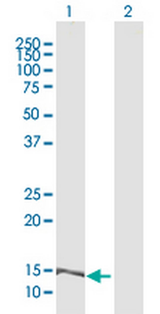 MRPL42 Antibody in Western Blot (WB)