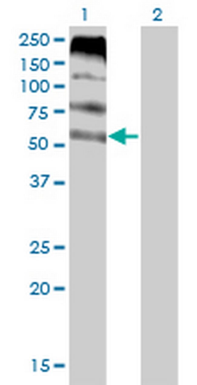 FLVCR Antibody in Western Blot (WB)