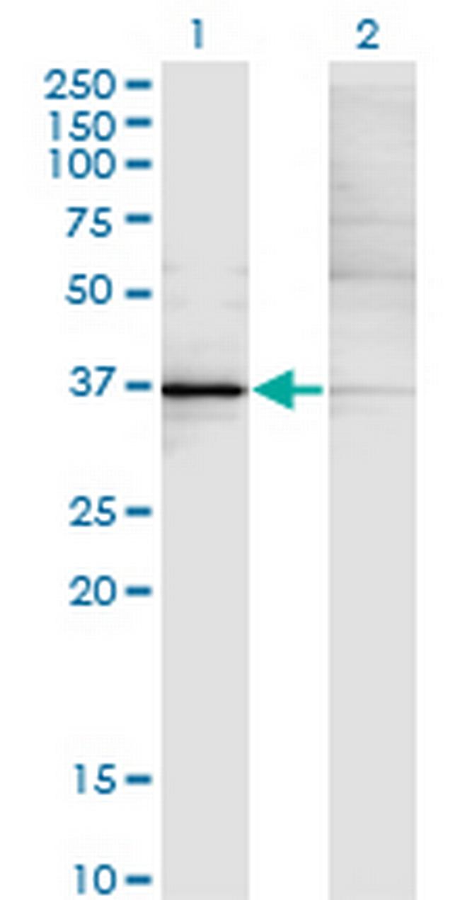 KLF15 Antibody in Western Blot (WB)