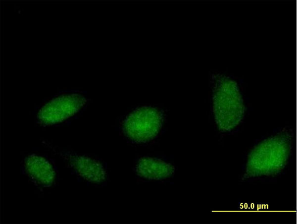 ATAD2 Antibody in Immunocytochemistry (ICC/IF)