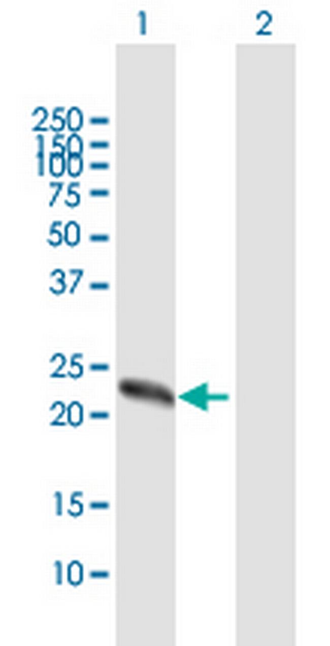 ZCCHC4 Antibody in Western Blot (WB)