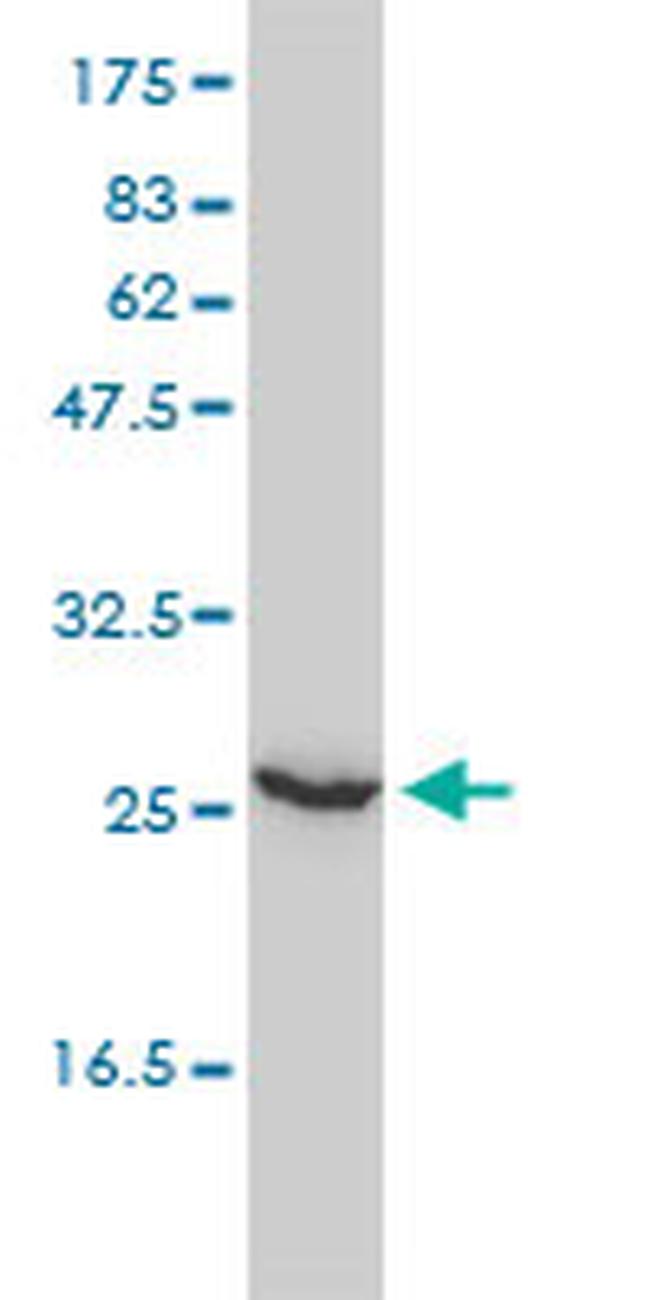UBE2T Antibody in Western Blot (WB)