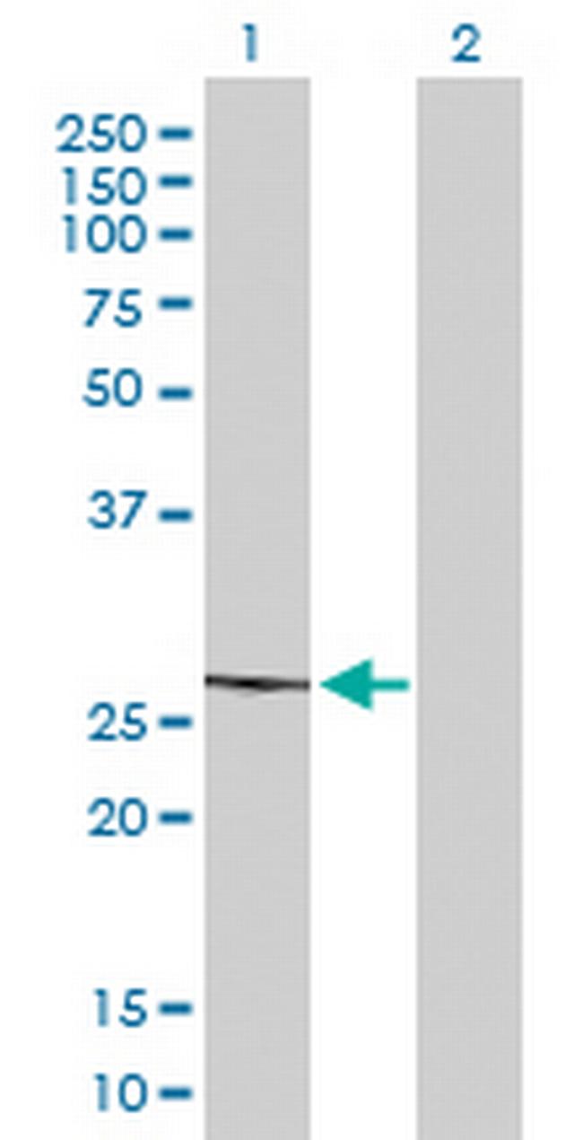 MRPL22 Antibody in Western Blot (WB)