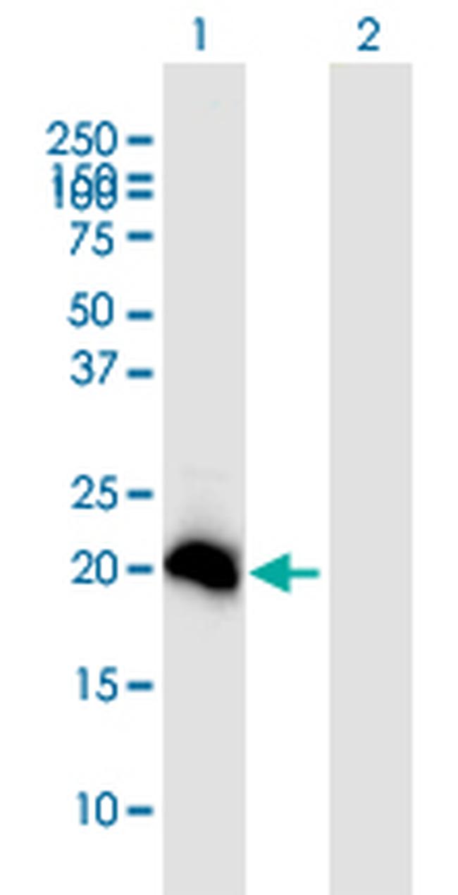 HEMK2 Antibody in Western Blot (WB)