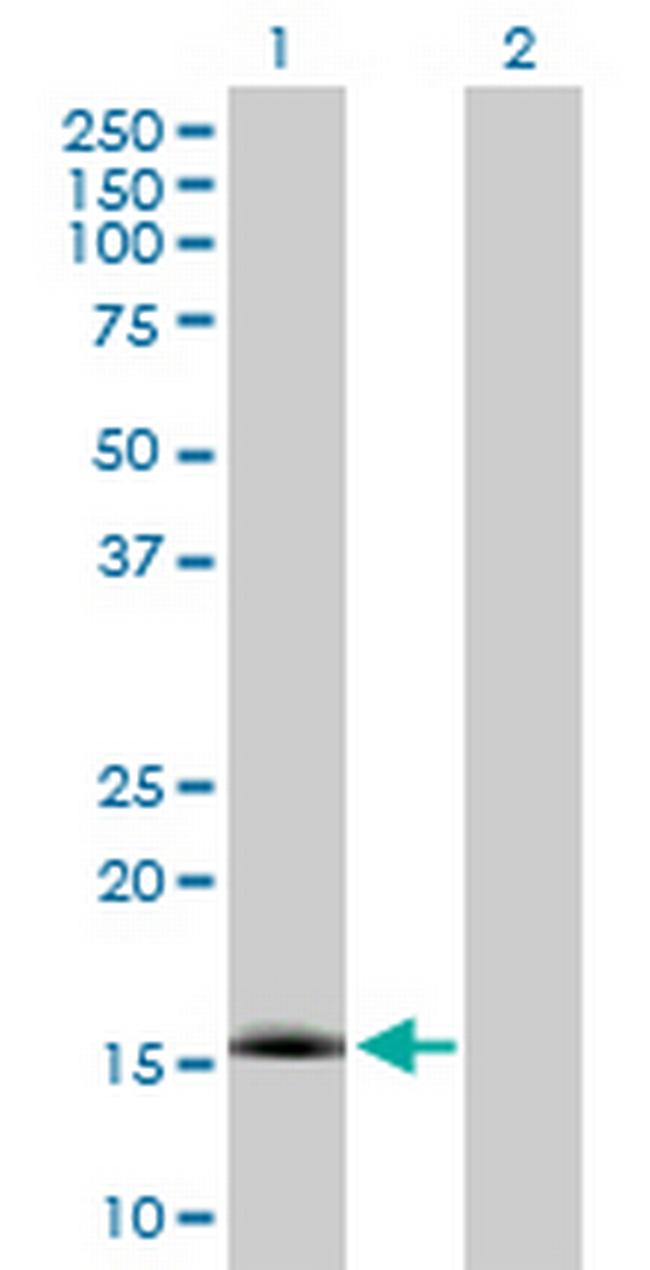 NXT1 Antibody in Western Blot (WB)