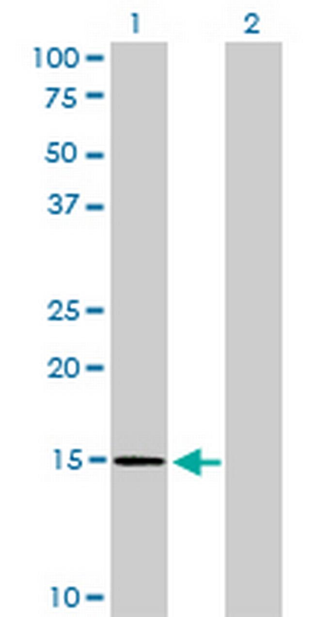 NXT1 Antibody in Western Blot (WB)