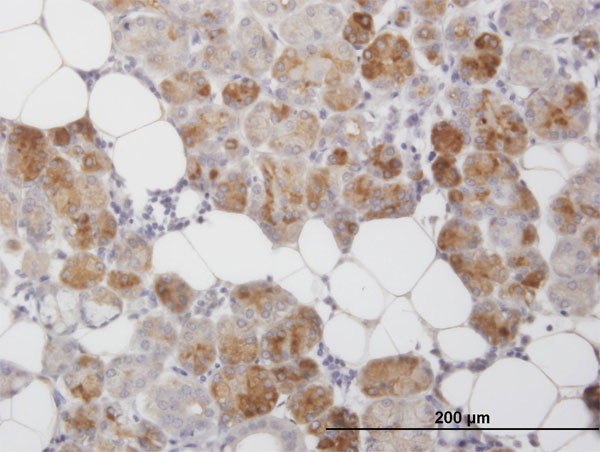 CLEC2D Antibody in Immunohistochemistry (Paraffin) (IHC (P))