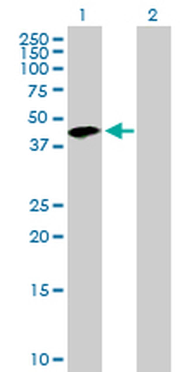 TMOD2 Antibody in Western Blot (WB)
