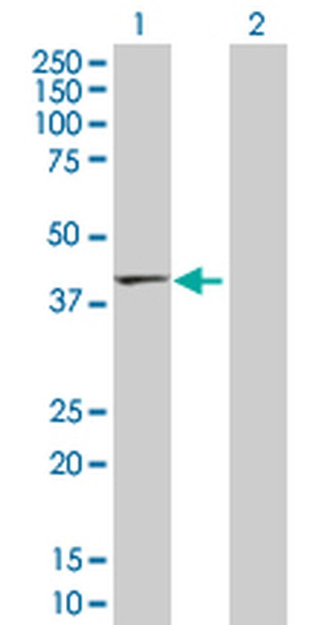 TMOD2 Antibody in Western Blot (WB)