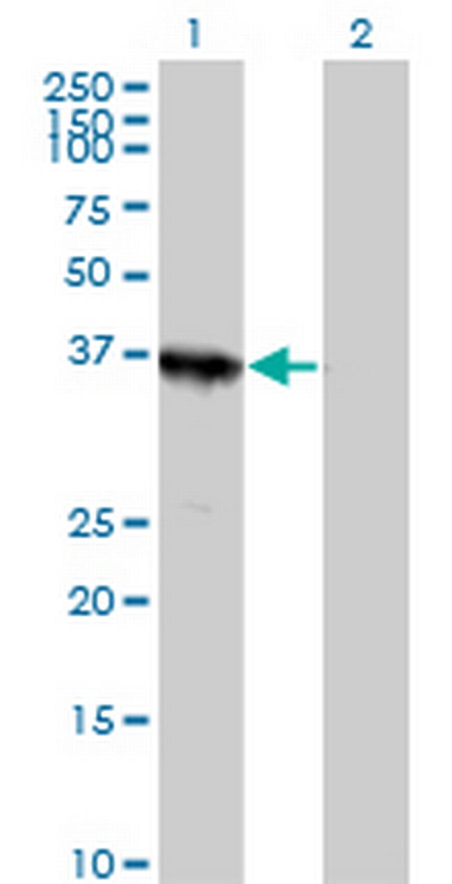 ABT1 Antibody in Western Blot (WB)