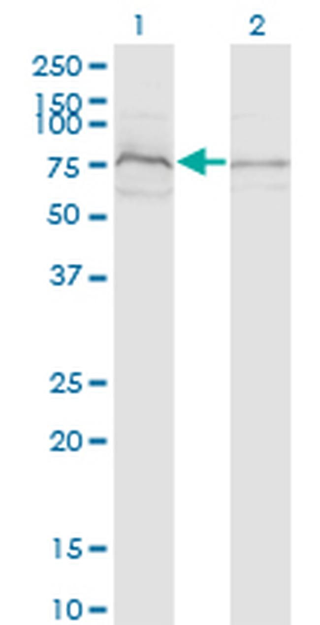 ZDHHC8 Antibody in Western Blot (WB)