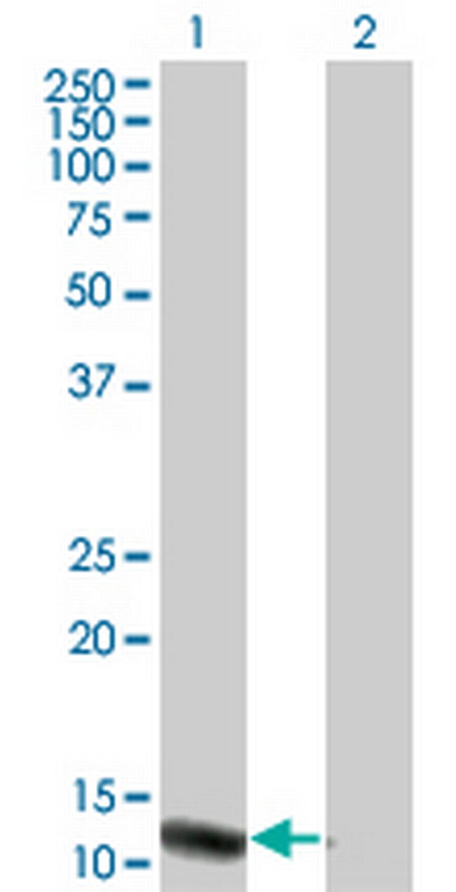 VPREB3 Antibody in Western Blot (WB)