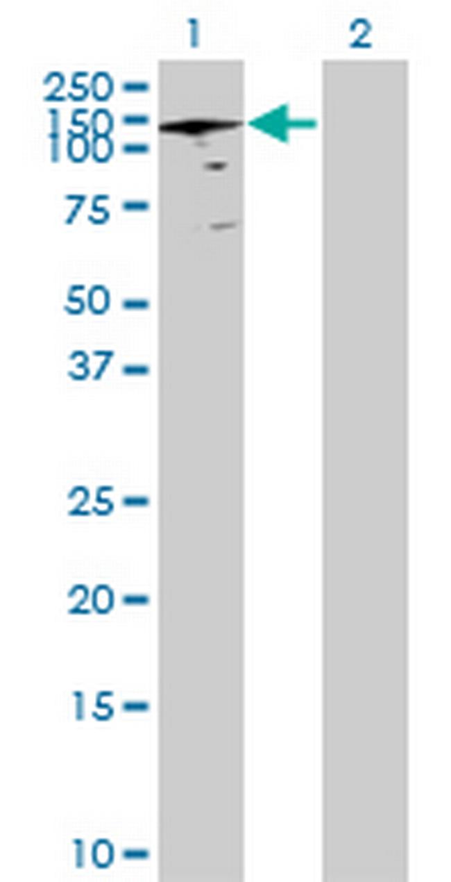 ANAPC2 Antibody in Western Blot (WB)