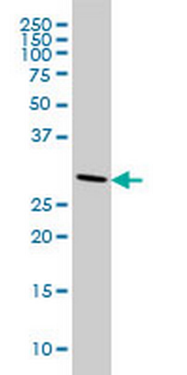 CNOT7 Antibody in Western Blot (WB)