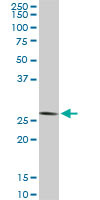 CNOT7 Antibody in Western Blot (WB)