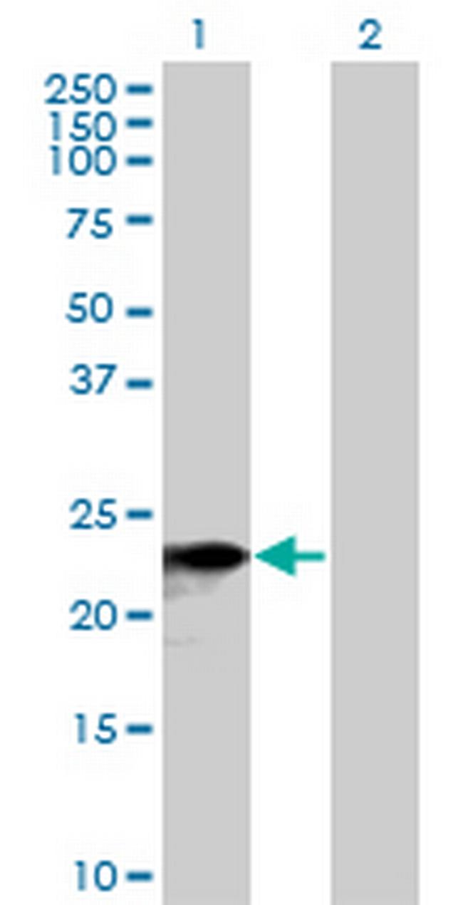 SNX10 Antibody in Western Blot (WB)